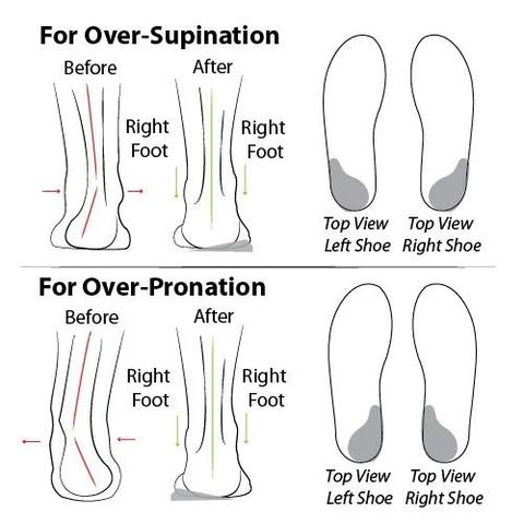 AZZY Premium Orthopedic Lace-Up Ankle Boots, Genuine Comfy Orthopedic Leather Boots, 2020 Design